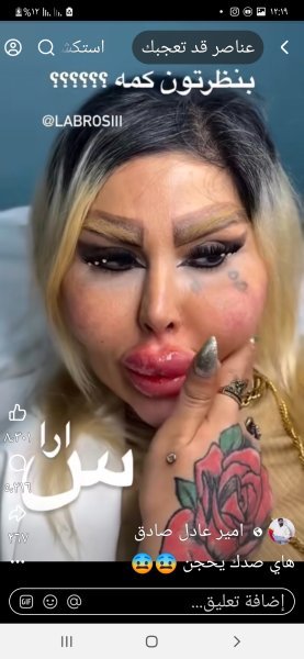Screenshot_٢٠٢٥١٠١٦-١٢١٩٤٤_Facebook.jpg