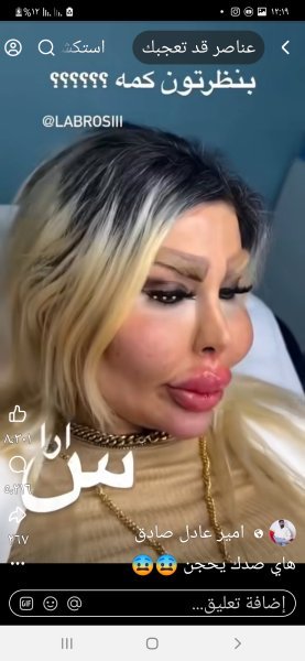 Screenshot_٢٠٢٥١٠١٦-١٢١٩٤٠_Facebook.jpg