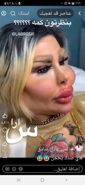Screenshot_٢٠٢٥١٠١٦-١٢١٩٢٧_Facebook.jpg