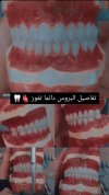 ٢٠٢٣٠٤٢٢_١٩٠٩٥١.jpg